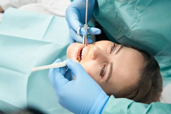 5 Ways Sedation Dentistry Saves Time For Patients And Dentists